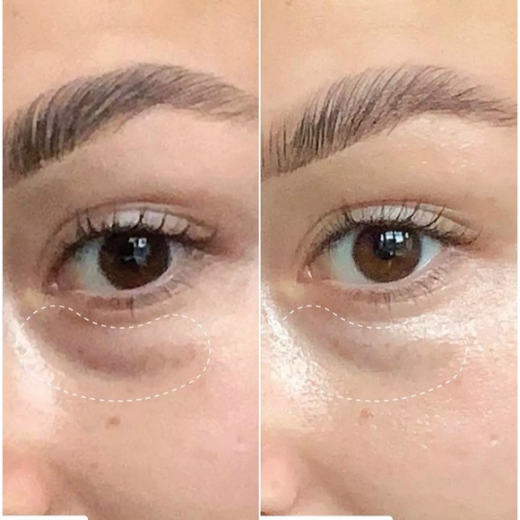 NWT….Ren Clean Skincare… Brightening dark circle cream - Picture 7 of 9